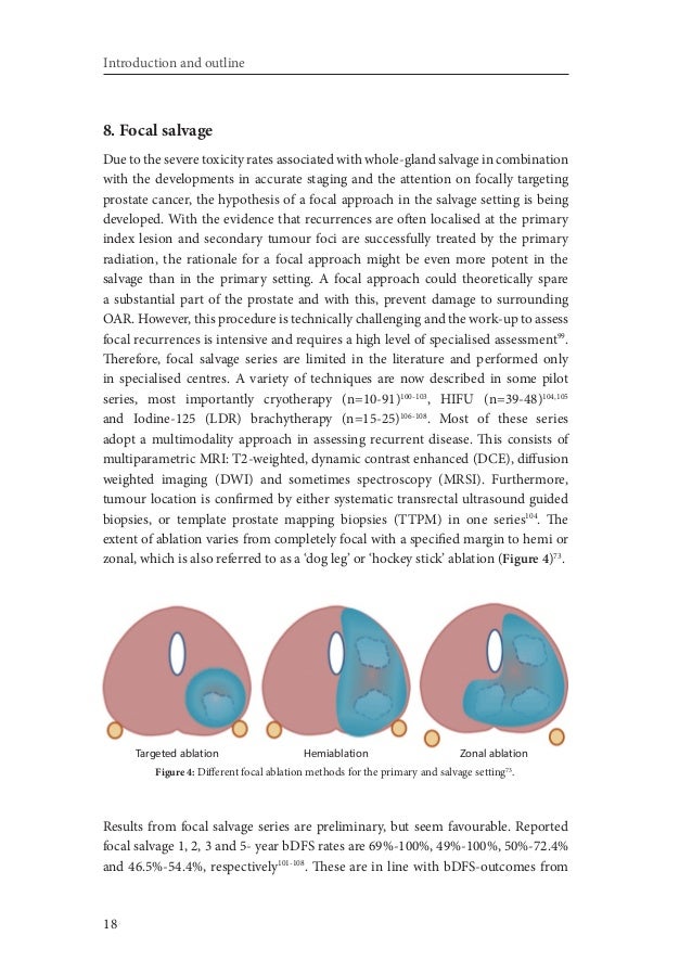 Prostate related thesis image