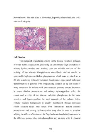 140
predominates. The new bone is disordered, is poorly mineralized, and lacks
structural integrity.
Lab Studies
The increased osteoclastic activity in the disease results in collagen
or bone matrix degradation, producing an abnormally high excretion of
urinary hydroxyproline and proline; both are reliable markers of the
activity of the disease Compensatory osteoblastic activity results in
abnormally high serum alkaline phosphatases which may be raised up to
20 fold in patients with active disease. Sudden rises may signal malignant
transformation in patients with longstanding disease, or be the result of
bony metastases in patients with extra-osseous primary tumors. Increases
in serum alkaline phosphatase and urinary hydroxyproline reflect the
extent and severity of the disease. Alkaline phosphatase is the more
sensitive and hydroxyproline the most accurate of the indices. Extra-
cellular calcium homeostasis is usually maintained, though increased
scrum calcium levels may result from immobility. Serum alkaline
phosphatase and urinary hydroxyproline may also be used to monitor
reliably the effects of treatment. As Paget's disease is relatively common in
the older age group, other osteodystrophics may co-exist with it. .Several
 