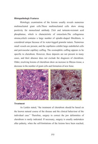 212
Histopathologic Features
Histologic examination of the lesions usually reveals numerous
multinucleated giant cells.These multinucleated cells show strong
positivity for monoclonal antibody 23c6 and tartarate-resistant acid
phosphatase, which is characteristic of osteoclasts.The collagenous
stroma,which contains a large number of spindle-shaped fibroblasts, is
considered unique because of its water-logged granular nature. Numerous
small vessels are present, and the capillaries exhibit large endothelial cells
and perivascular capillary cuffing. The eosinophilic cuffing appears to be
specific to cherubism. However, these deposits are not present in many
cases, and their absence does not exclude the diagnosis of cherubism.
Older, resolving lesions of cherubism show an increase in fibrous tissue, a
decrease in the number of giant cells and formation of new bone.
Treatment
the known natural course of the disease and the clinical behaviour of the
Therefore, surgery to correct the jaw deformities of
cherubism is rarely indicated. If necessary, surgery is usually undertaken
after puberty, when the self-limitations of the lesions have been reached,
 