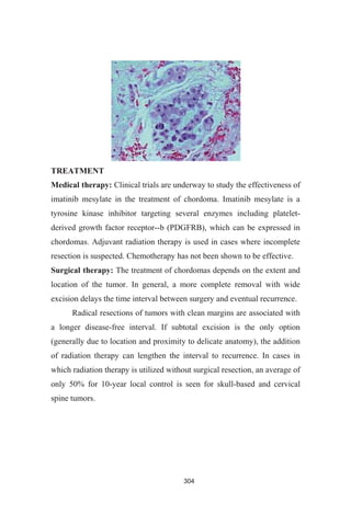 304
TREATMENT
Medical therapy: Clinical trials are underway to study the effectiveness of
imatinib mesylate in the treatment of chordoma. Imatinib mesylate is a
tyrosine kinase inhibitor targeting several enzymes including platelet-
derived growth factor receptor--b (PDGFRB), which can be expressed in
chordomas. Adjuvant radiation therapy is used in cases where incomplete
resection is suspected. Chemotherapy has not been shown to be effective.
Surgical therapy: The treatment of chordomas depends on the extent and
location of the tumor. In general, a more complete removal with wide
excision delays the time interval between surgery and eventual recurrence.
Radical resections of tumors with clean margins are associated with
a longer disease-free interval. If subtotal excision is the only option
(generally due to location and proximity to delicate anatomy), the addition
of radiation therapy can lengthen the interval to recurrence. In cases in
which radiation therapy is utilized without surgical resection, an average of
only 50% for 10-year local control is seen for skull-based and cervical
spine tumors.
 
