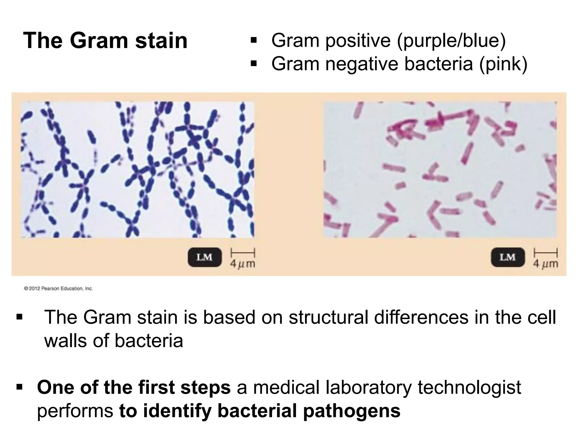 The Gram stain
 The Gram stain is based on structural differences in the cell
walls of bacteria
 One of the first steps a medical laboratory technologist
performs to identify bacterial pathogens
 Gram positive (purple/blue)
 Gram negative bacteria (pink)
 