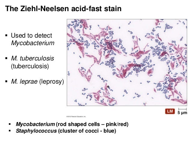 gram stain lab report gram stain lab report