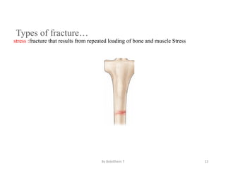 2 note on major Bone and joint injuries.pptx
