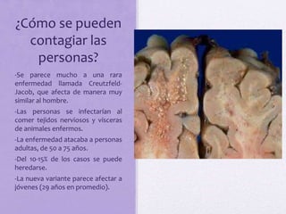 ¿Cómo se pueden
contagiar las
personas?
-Se parece mucho a una rara
enfermedad llamada Creutzfeld-
Jacob, que afecta de manera muy
similar al hombre.
-Las personas se infectarían al
comer tejidos nerviosos y vísceras
de animales enfermos.
-La enfermedad atacaba a personas
adultas, de 50 a 75 años.
-Del 10-15% de los casos se puede
heredarse.
-La nueva variante parece afectar a
jóvenes (29 años en promedio).
 