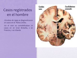 Casos registrados
en el hombre
-Octubre de 1999 se diagnosticaron
20 casos en el Reino Unido.
-En el 2001 se contabilizaban 70
casos en en Gran Bretaña, 2 en
Francia y 1 en Irlanda
 