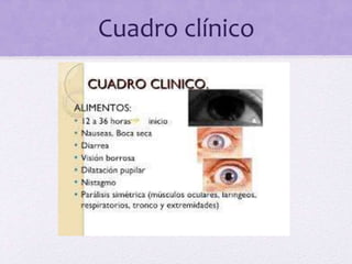 Cuadro clínico
 