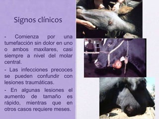Signos clínicos
- Comienza por una
tumefacción sin dolor en uno
o ambos maxilares, casi
siempre a nivel del molar
central.
- Las infecciones precoces
se pueden confundir con
lesiones traumáticas.
- En algunas lesiones el
aumento de tamaño es
rápido, mientras que en
otros casos requiere meses.
 