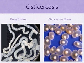 Cisticercosis
Proglótidos Cisticercos libres
 