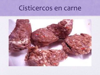 Cisticercos en carne
 