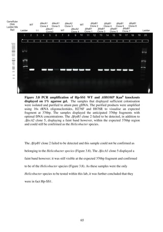65
Figure 3.8 PCR amplification of Hp-SS1 WT and ΔIROMP KanR
knockouts
displayed on 1% agarose gel. The samples that displayed sufficient colonisation
were isolated and purified to attain pure gDNA. The purified products were amplified
using 16s rRNA oligonucleotides, H276F and H676R to visualise an expected
fragment at 376bp. The samples displayed the anticipated 376bp fragments with
optimal DNA concentrations. The ΔfrpB1 clone 2 failed to be detected, in addition to
ΔfecA2 clone 5, displaying a faint band however, within the expected 376bp region
and could still be confirmed as the Helicobacter species.
The ΔfrpB1 clone 2 failed to be detected and this sample could not be confirmed as
belonging to the Helicobacter species (Figure 3.8). The ΔfecA1 clone 5 displayed a
faint band however; it was still visible at the expected 376bp fragment and confirmed
to be of the Helicobacter species (Figure 3.8). As these samples were the only
Helicobacter species to be tested within this lab, it was further concluded that they
were in fact Hp-SS1.
 