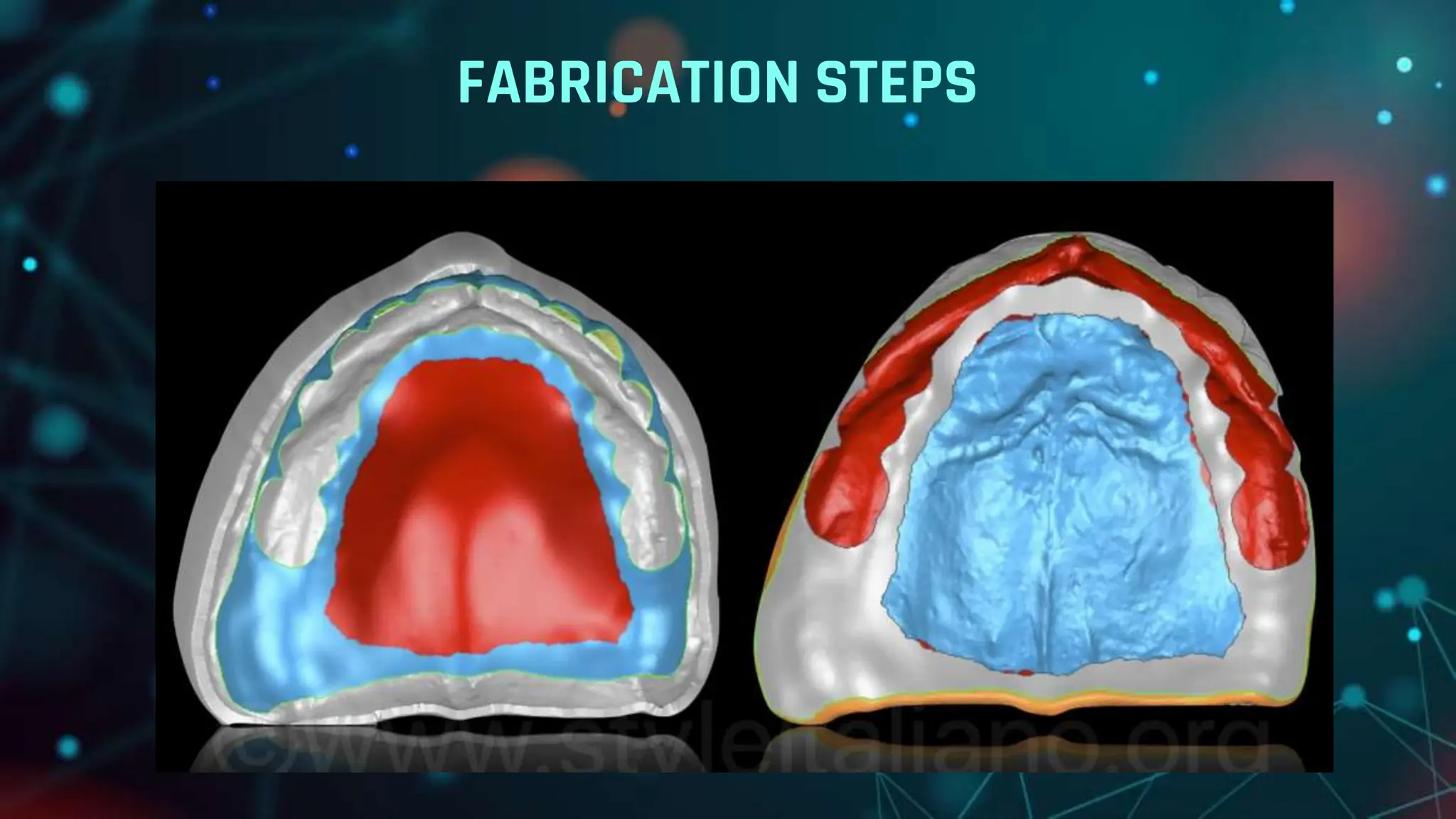 CAD CAM DENTURES IN PROSTHODONTICS : Dental advancements | PPTX