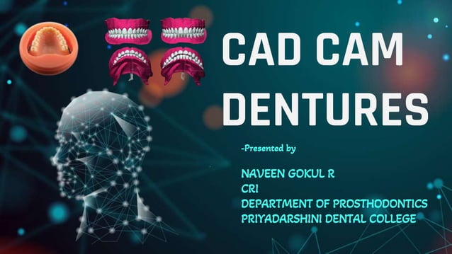 CAD CAM DENTURES IN PROSTHODONTICS : Dental advancements | PPTX ...