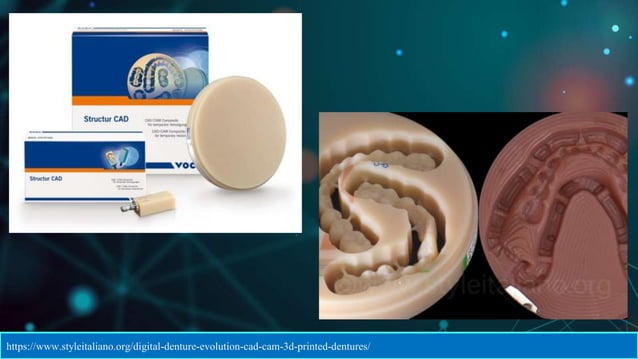 CAD CAM DENTURES IN PROSTHODONTICS : Dental advancements | PPTX ...