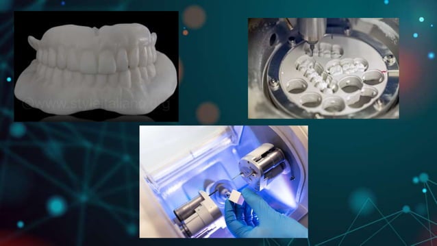 CAD CAM DENTURES IN PROSTHODONTICS : Dental advancements | PPTX ...