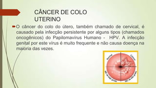 CÂNCER DE COLO
UTERINO
O câncer do colo do útero, também chamado de cervical, é
causado pela infecção persistente por alguns tipos (chamados
oncogênicos) do Papilomavírus Humano - HPV. A infecção
genital por este vírus é muito frequente e não causa doença na
maioria das vezes.
 