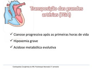 Cardiopatias Congênitas do RN; Fisioterapia Neonatal; 6° semestre Cianose progressiva após as primeiras horas de vida Hipoxemia grave Acidose metabólica evolutiva 