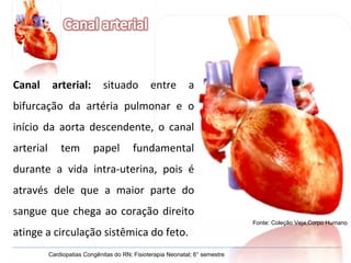 Canal arterial:  situado entre a bifurcação da artéria pulmonar e o início da aorta descendente, o canal arterial tem papel fundamental durante a vida intra-uterina, pois é através dele que a maior parte do sangue que chega ao coração direito atinge a circulação sistêmica do feto. Cardiopatias Congênitas do RN; Fisioterapia Neonatal; 6° semestre Fonte: Coleção Veja,Corpo Humano 