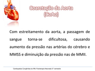 Cardiopatias Congênitas do RN; Fisioterapia Neonatal; 6° semestre Com estreitamento da aorta, a passagem de sangue torna-se dificultosa, causando aumento da pressão nas artérias do cérebro e MMSS e diminuição da pressão nas de MMII. 
