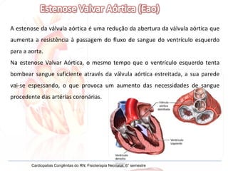 Cardiopatias Congênitas do RN; Fisioterapia Neonatal; 6° semestre A estenose da válvula aórtica é uma redução da abertura da válvula aórtica que aumenta a resistência à passagem do fluxo de sangue do ventrículo esquerdo para a aorta. Na estenose Valvar Aórtica, o mesmo tempo que o ventrículo esquerdo tenta bombear sangue suficiente através da válvula aórtica estreitada, a sua parede vai-se espessando, o que provoca um aumento das necessidades de sangue procedente das artérias coronárias. 
