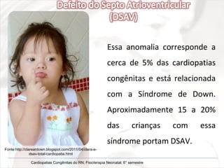 Essa anomalia corresponde a cerca de 5% das cardiopatias congênitas e está relacionada com a Síndrome de Down. Aproximadamente 15 a 20% das crianças com essa síndrome portam DSAV. Fonte:http://clareardown.blogspot.com/2011/04/clara-e-dsav-total-cardiopatia.html Cardiopatias Congênitas do RN; Fisioterapia Neonatal; 6° semestre 
