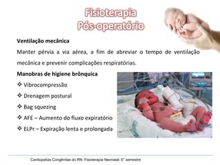 Cardiopatias Congênitas do RN; Fisioterapia Neonatal; 6° semestre Ventilação mecânica Manter pérvia a via aérea, a fim de abreviar o tempo de ventilação mecânica e prevenir complicações respiratórias. Manobras de higiene brônquica Vibrocompressão Drenagem postural Bag squezing AFE – Aumento do fluxo expiratório ELPr – Expiração lenta e prolongada 