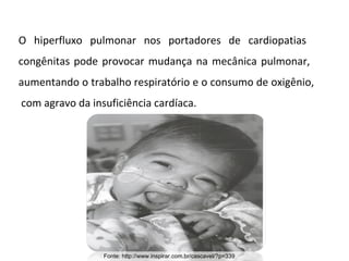 Fonte: http://www.inspirar.com.br/cascavel/?p=339 O hiperfluxo pulmonar nos portadores de cardiopatias  congênitas pode provocar mudança na mecânica pulmonar,  aumentando o trabalho respiratório e o consumo de oxigênio,  com agravo da insuficiência cardíaca. 