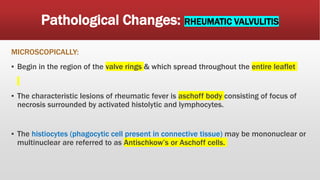 Pathological Changes: RHEUMATIC VALVULITIS
MICROSCOPICALLY:
▪ Begin in the region of the valve rings & which spread throughout the entire leaflet
▪ The characteristic lesions of rheumatic fever is aschoff body consisting of focus of
necrosis surrounded by activated histolytic and lymphocytes.
▪ The histiocytes (phagocytic cell present in connective tissue) may be mononuclear or
multinuclear are referred to as Antischkow’s or Aschoff cells.
 