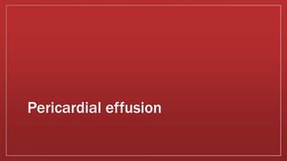 Pericardial effusion
 