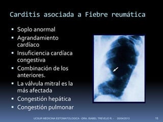 Carditis asociada a Fiebre reumática

 Soplo anormal
 Agrandamiento
  cardíaco
 Insuficiencia cardíaca
  congestiva
 Combinación de los
  anteriores.
 La válvula mitral es la
  más afectada
 Congestión hepática
 Congestión pulmonar
        UCSUR MEDICINA ESTOMATOLOGICA -DRA. ISABEL TREVEJO R. -   05/04/2013   15
 