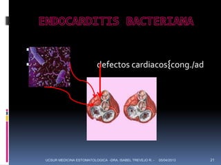 
                            defectos cardiacos{cong./ad




    UCSUR MEDICINA ESTOMATOLOGICA -DRA. ISABEL TREVEJO R. -   05/04/2013   21
 