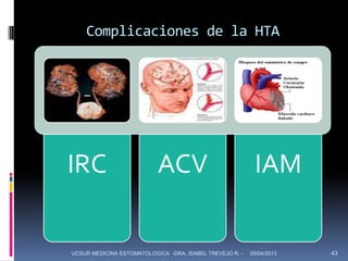 Complicaciones de la HTA




IRC                        ACV                             IAM

UCSUR MEDICINA ESTOMATOLOGICA -DRA. ISABEL TREVEJO R. -   05/04/2013   43
 