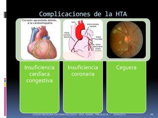 Complicaciones de la HTA




Insuficiencia              Insuficiencia                       Ceguera
  cardíaca                   coronaria
 congestiva




   UCSUR MEDICINA ESTOMATOLOGICA -DRA. ISABEL TREVEJO R. -   05/04/2013   44
 