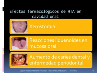 Efectos farmacológicos de HTA en
          cavidad oral

              Xerostomia

              Reacciones liquenoides en
              mucosa oral
              Aumento de caries dental y
              enfermedad periodontal
    UCSUR MEDICINA ESTOMATOLOGICA -DRA. ISABEL TREVEJO R. -   05/04/2013   47
 