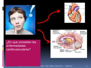 ¿En que consisten las
enfermedades
cardiovasculares?




        UCSUR MEDICINA ESTOMATOLOGICA -DRA. ISABEL TREVEJO R. -   05/04/2013   4
 