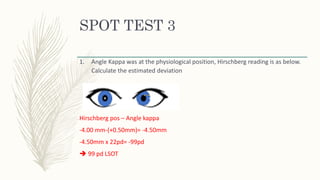 SPOT TEST 3
1. Angle Kappa was at the physiological position, Hirschberg reading is as below.
Calculate the estimated deviation
Hirschberg pos – Angle kappa
-4.00 mm-(+0.50mm)= -4.50mm
-4.50mm x 22pd= -99pd
 99 pd LSOT
 