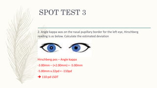 SPOT TEST 3
2. Angle kappa was on the nasal pupillary border for the left eye, Hirschberg
reading is as below. Calculate the estimated deviation
Hirschberg pos – Angle kappa
-3.00mm – (+2.00mm) = -5.00mm
-5.00mm x 22pd = -110pd
 110 pd LSOT
 