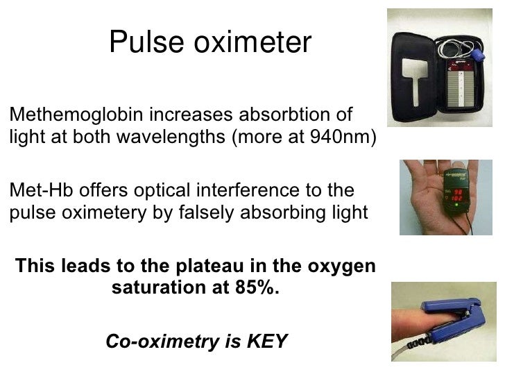 2 cases of chest pain