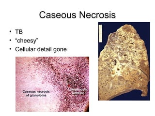 2 Cell Injury, Adaptation, & Death.ppt,l | PPT