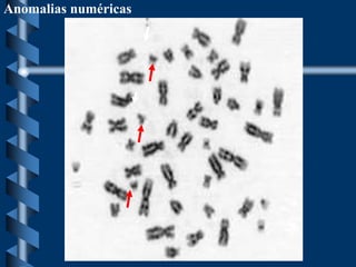 Anomalias numéricas
 