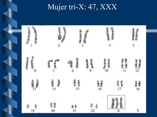 Mujer tri-X: 47, XXX
 