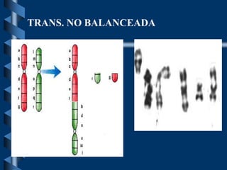 TRANS. NO BALANCEADA
 