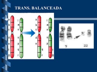 TRANS. BALANCEADA
 