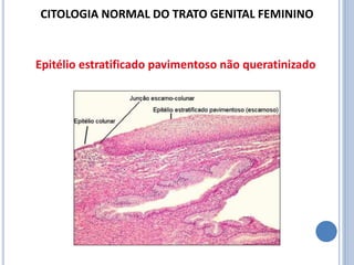 Epitélio estratificado pavimentoso não queratinizado
CITOLOGIA NORMAL DO TRATO GENITAL FEMININO
 