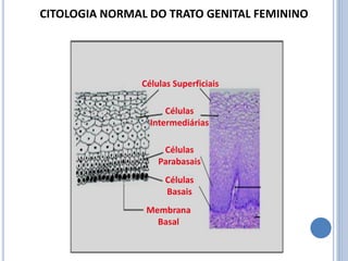 Células Superficiais
Células
Intermediárias
Células
Parabasais
Células
Basais
Membrana
Basal
CITOLOGIA NORMAL DO TRATO GENITAL FEMININO
 