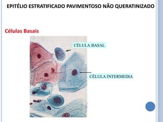 Células Basais
EPITÉLIO ESTRATIFICADO PAVIMENTOSO NÃO QUERATINIZADO
 