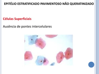 Células Superficiais
Ausência de pontes intercelulares
EPITÉLIO ESTRATIFICADO PAVIMENTOSO NÃO QUERATINIZADO
 