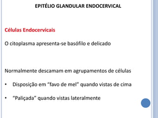 Células Endocervicais
O citoplasma apresenta-se basófilo e delicado
Normalmente descamam em agrupamentos de células
• Disposição em “favo de mel” quando vistas de cima
• “Paliçada” quando vistas lateralmente
EPITÉLIO GLANDULAR ENDOCERVICAL
 