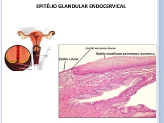EPITÉLIO GLANDULAR ENDOCERVICAL
 