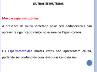 A presença de muco secretado pelas céls endocervicais não
apresenta significado clínico no exame de Papanicolaou
Os espermatozóides muitas vezes não apresentam cauda,
podendo ser confundido com leveduras Candida spp
Muco e espermatozóides
OUTRAS ESTRUTURAS
 