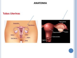 Tubas Uterinas
ANATOMIA
 